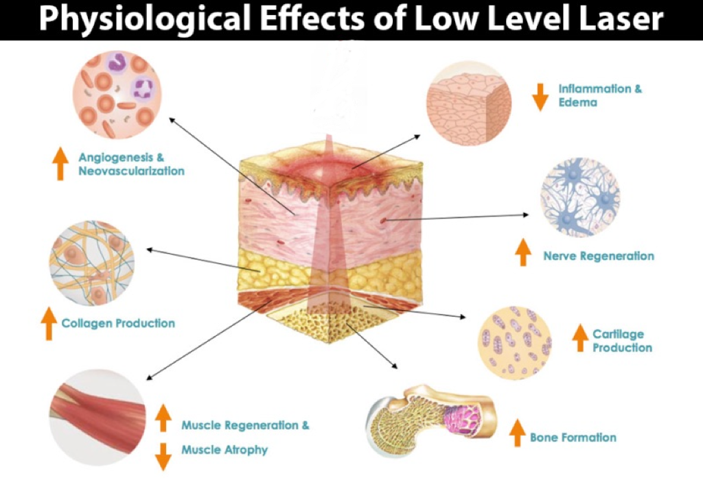 Physiological effect of low level laser light therapy Physiological effect of low level laser light therapy