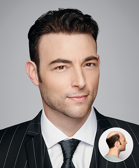 Virtual Reality Hair - Non-Surgical Hair Replacement