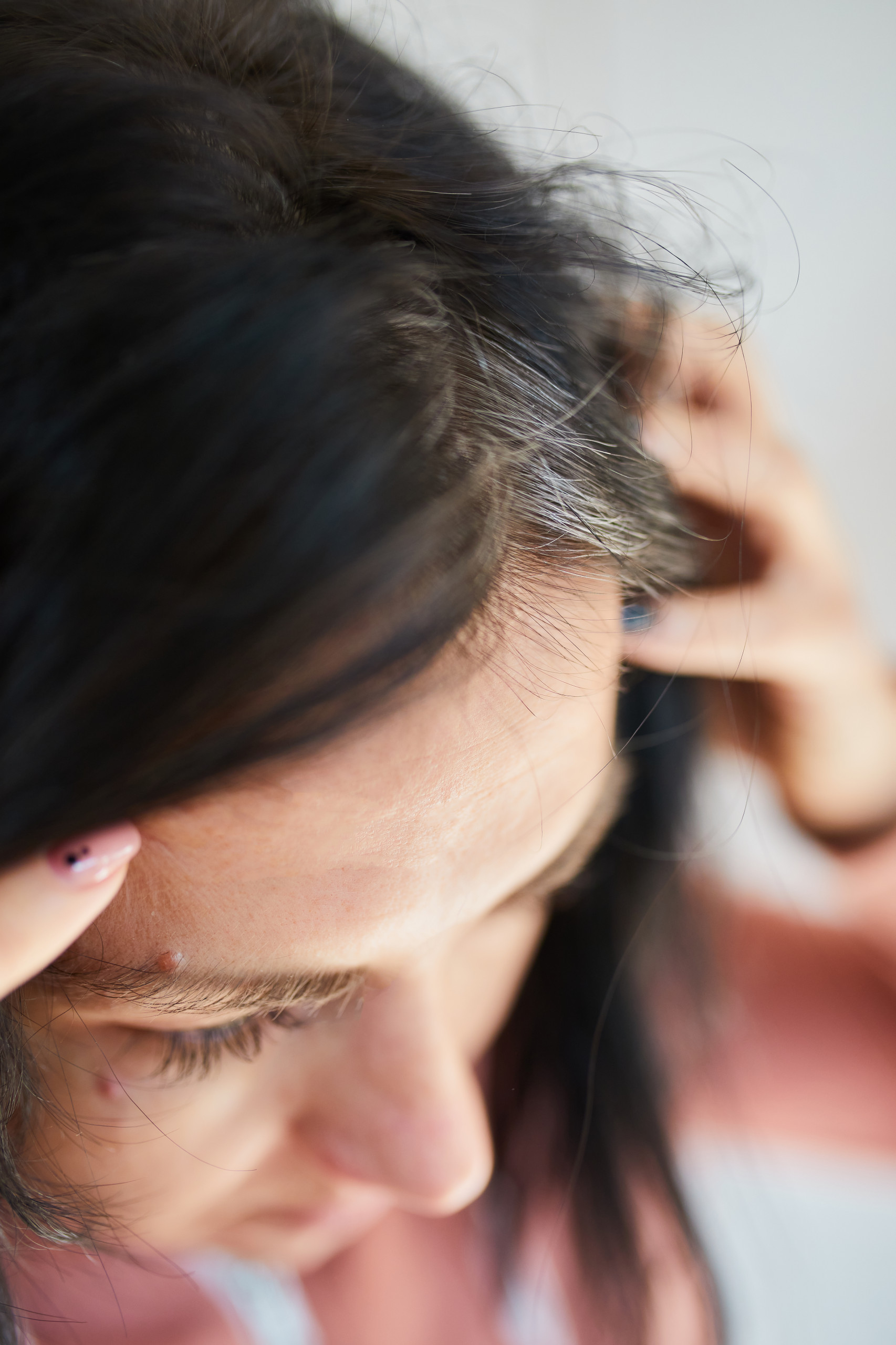 Medical Hair Loss