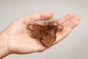 Clump of hair in hand
