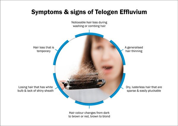 telogen effluvium