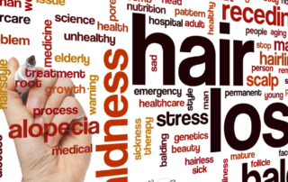 Managing Hair Loss: Finding the Right Solution for You